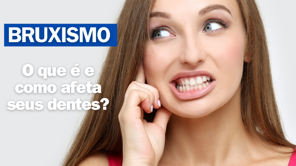 Ilustração representando o bruxismo, o hábito de ranger os dentes